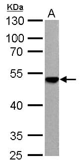IHC-plus™ Polyclonal Rabbit anti-Human ENO3 / Enolase 3 Antibody (aa196-434, IHC, WB)
