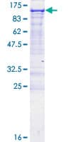 Human EPB41L1 / 4.1N Protein (Recombinant GST)