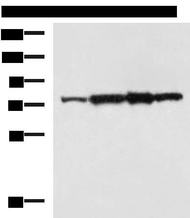 Polyclonal Rabbit anti-Human CAPN6 / Calpain 6 Antibody (WB)