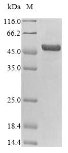 Porcine Circovirus 2 Cap Protein (Recombinant 10His-SUMO, N-terminus + Myc, C-terminus)