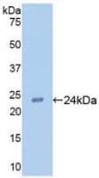 TLR2 Antibody (aa47-245)