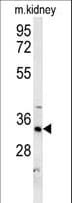 HSD17B13 Antibody (aa81-110)