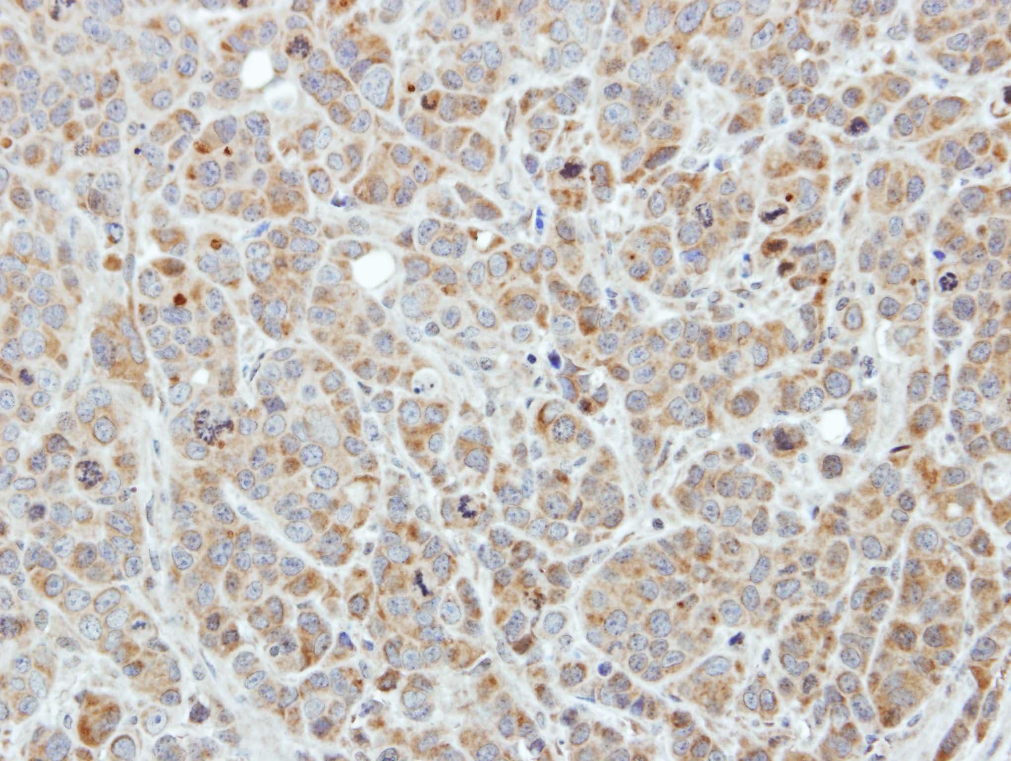 EDC3 Antibody (aa127-376)