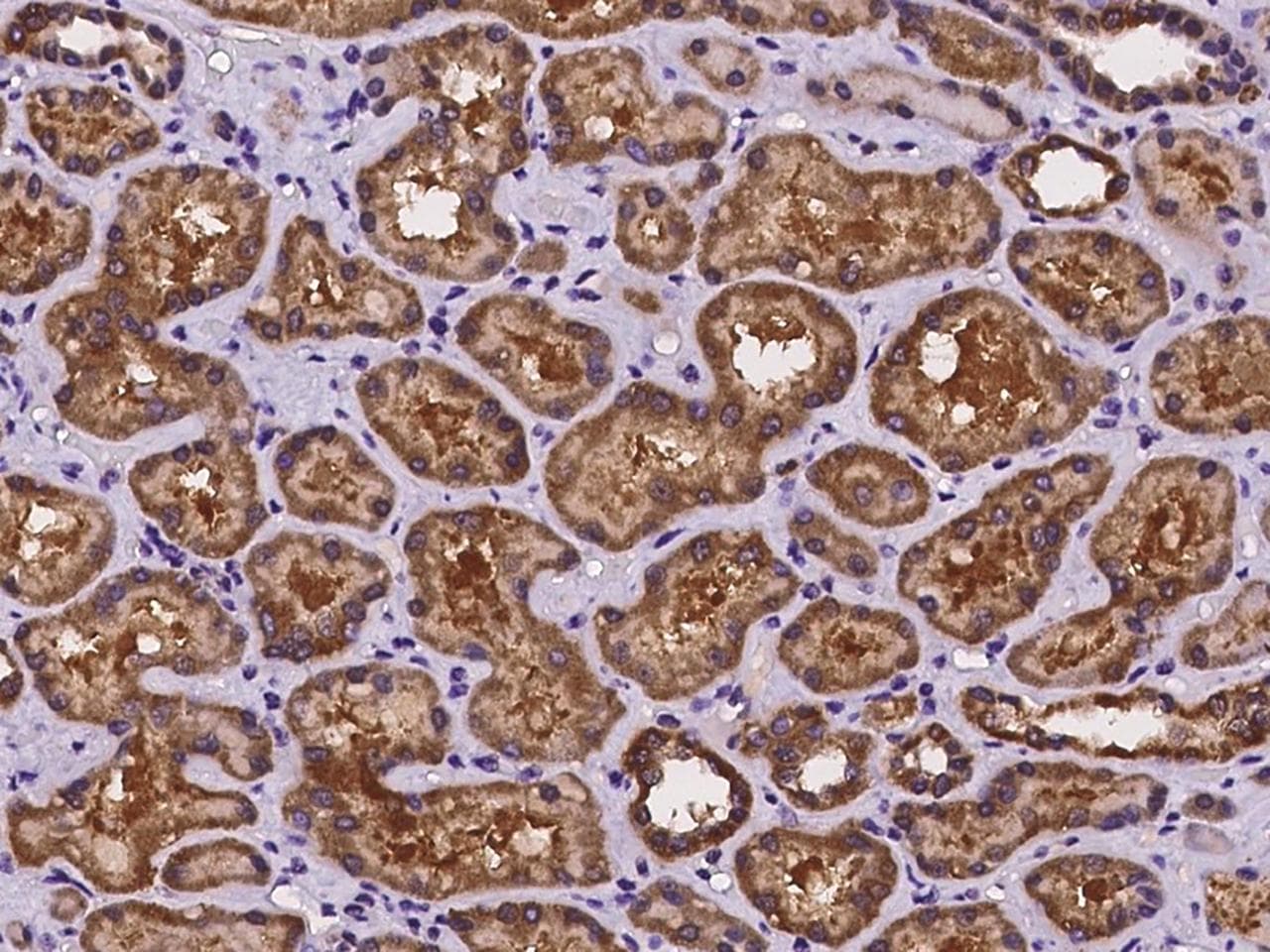 CNKSR1 Antibody