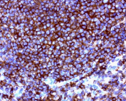 CD20 Antibody (clone UMAB58, Carrier-free)