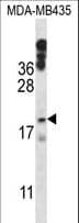 HIST1H1E Antibody (aa1-30)