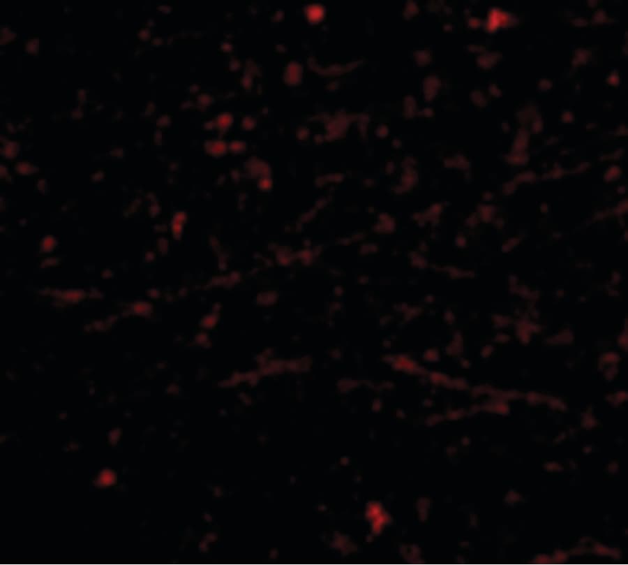 Polyclonal Rabbit anti-Human ACKR1 / DARC Antibody (IHC, IF, WB)