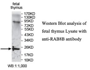 Polyclonal Rabbit anti-Human RAB8B Antibody (aa1-207, WB)