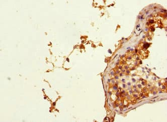 Polyclonal Rabbit anti-Human BCAP / PHF11 Antibody (IHC, WB)