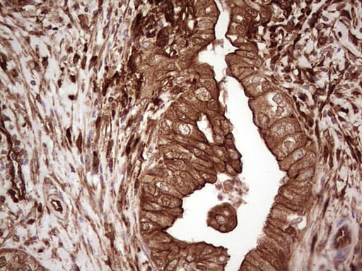 LGALS9 / Galectin 9 Antibody (clone OTI1D12)