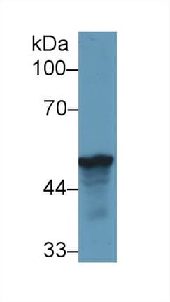 LRG1 / LRG Antibody (aa39-308)