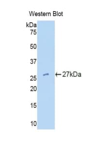 TFPI2 Antibody (aa26-230, Cy3)