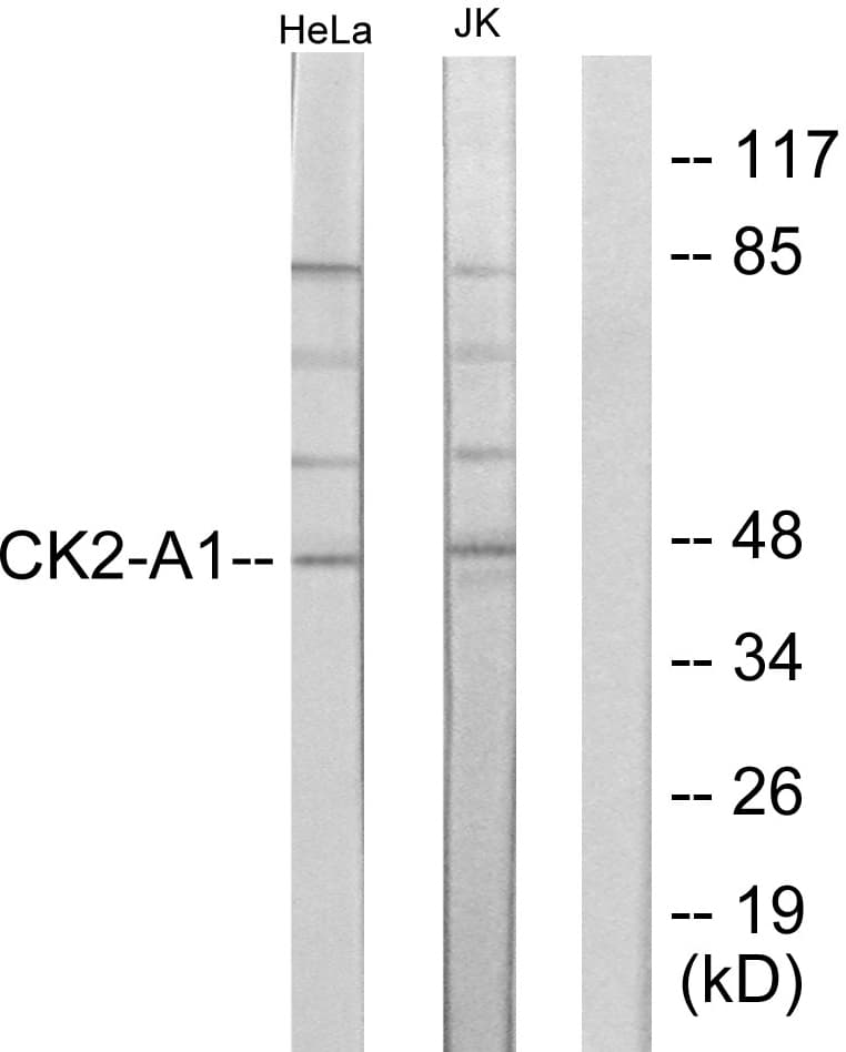 CSNK2A1 Antibody (aa221-270)