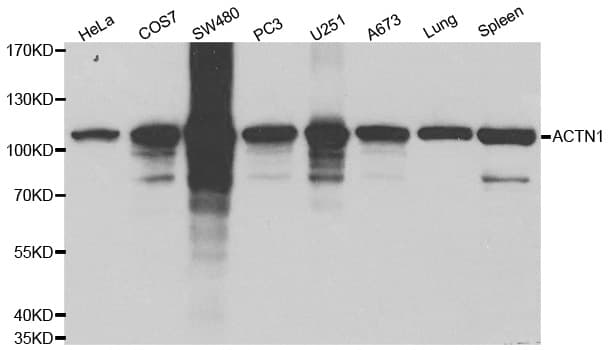 IHC-plus™ ACTN1 Antibody