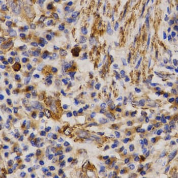 MMP25 / Leukolysin Antibody