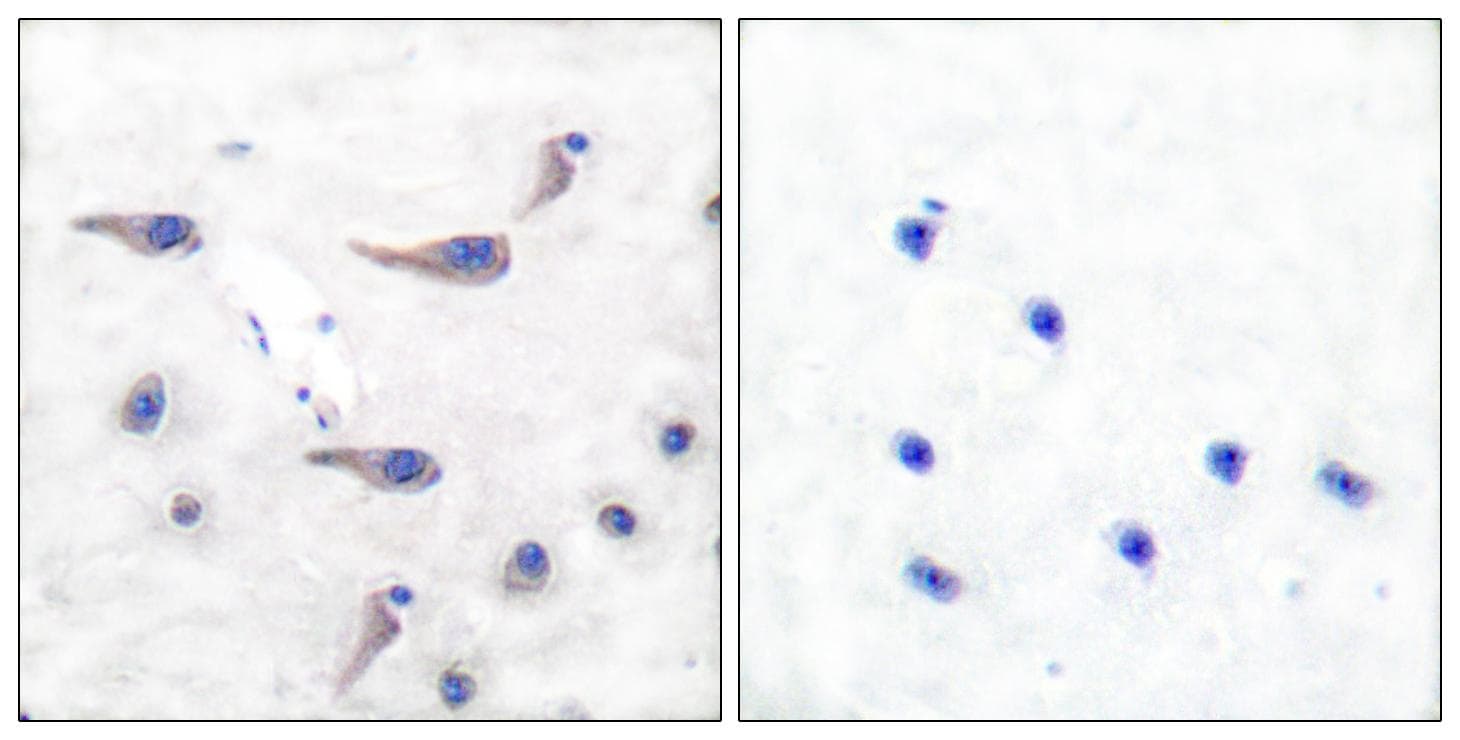 GRIA1 / GLUR1 Antibody (phospho-Ser863)