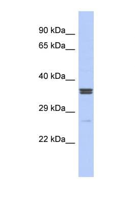 Polyclonal Rabbit anti-Human ZNF586 Antibody (aa161-210, WB)