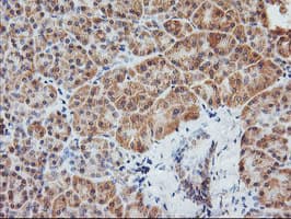 AGPAT5 Antibody (clone OTI1D4)