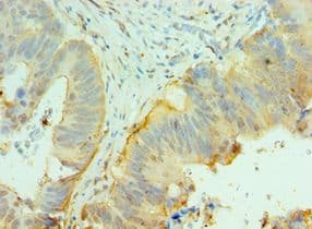Polyclonal Rabbit anti-Human CNOT8 Antibody (aa1-292, IHC)