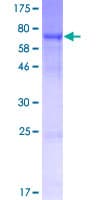 Human SRPX2 Protein (Recombinant GST)