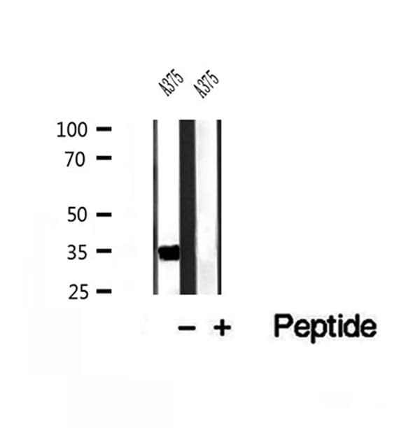 DHRS3 / SDR1 Antibody