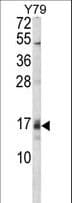 GADD45A / GADD45 Antibody (aa133-165)