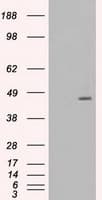 MAP2K4 / MKK4 Antibody (clone OTI1D6)