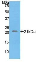 FBN1 / Fibrillin 1 Antibody (aa723-902)