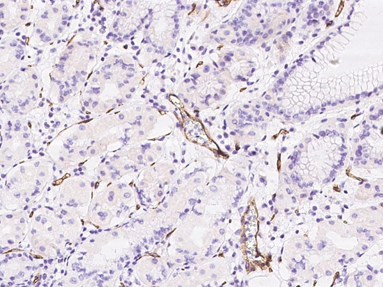 PV1 / PLVAP Antibody