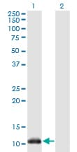 NDUFA5 Antibody (clone 4A2)