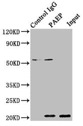 Polyclonal Rabbit anti-Human PAEP / Glycodelin / GdF Antibody (IHC)