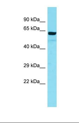 ARMC5 Antibody (aa66-115)