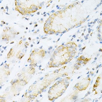 Polyclonal Rabbit anti-Human SULT2A1 / Sulfotransferase 2A1 Antibody (IHC, WB)