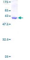 Human ANXA5 / Annexin V Protein (Recombinant GST)