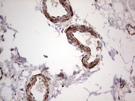 Monoclonal Mouse anti-Human PKM2 Antibody (clone 11B11, IHC, WB)