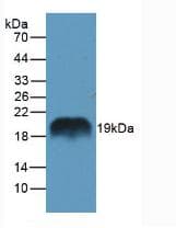 REG1A Antibody (aa10-165, APC)