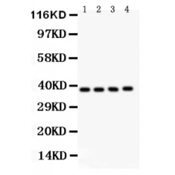 Polyclonal Rabbit anti-Human PINX1 Antibody (aa54-83, WB)