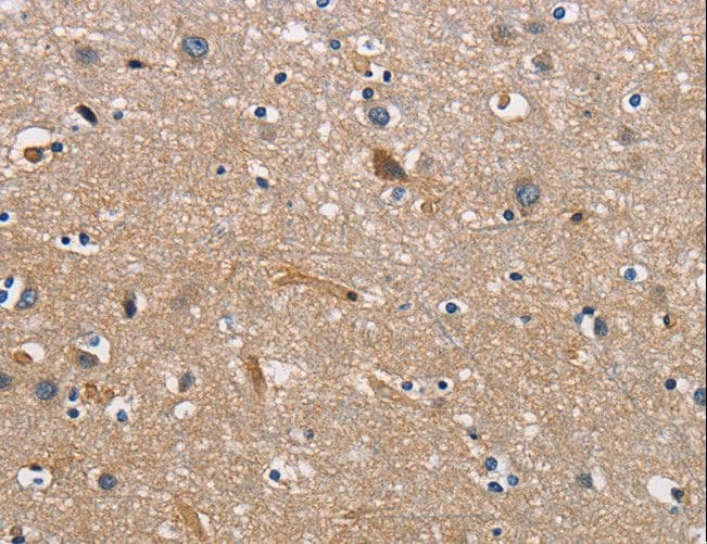 CBY1 / PGEA1 Antibody