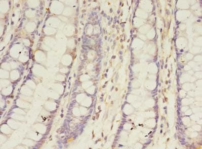 BTN2A1 Antibody