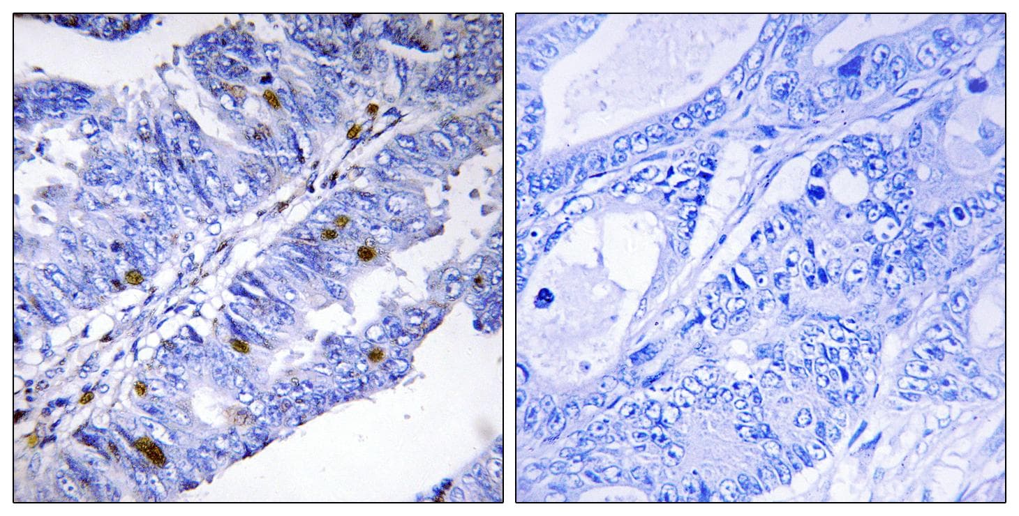 NR4A1 / NUR77 Antibody (phospho-Ser351)
