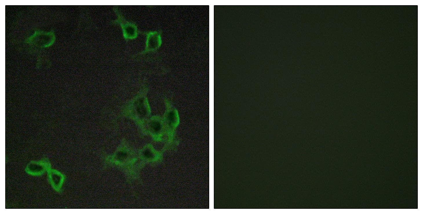 ACKR4 / CCRL1 / CCR11 Antibody
