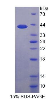 Human PIM3 / PIM-3 Protein (Recombinant His-T7)