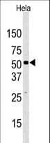 IHC-plus™ KDM4D / JMJD2D Antibody (aa484-516)