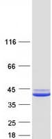 Human SGTA / SGT Protein (Recombinant Myc-DDK (Flag))
