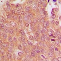 MID1 Antibody (N-Terminus)