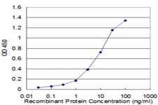PPM1D / WIP1 Antibody (clone 4D1)