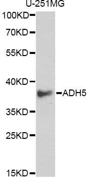 Polyclonal Rabbit anti-Human ADH5 Antibody (IHC, WB)