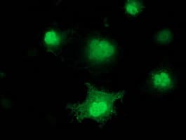 Monoclonal Mouse anti-Human PNMT Antibody (clone OTI1D5, IF, WB)