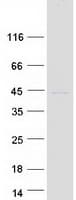 Human TNNT3 Protein (Recombinant Myc-DDK (Flag))
