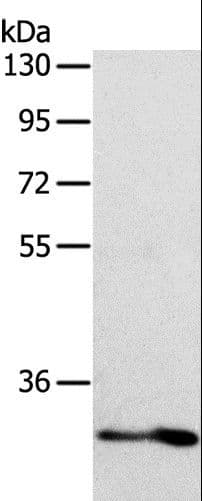 IL1RL1 Antibody